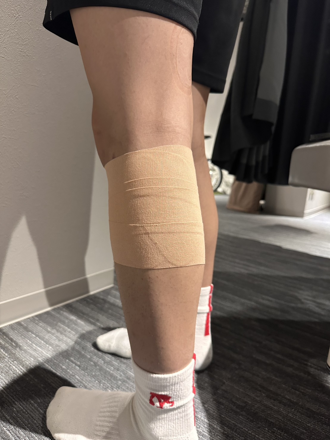 下腿部の筋挫傷